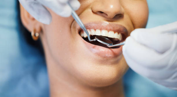 Best Emergency Dental Extractions in Palmyra, IN