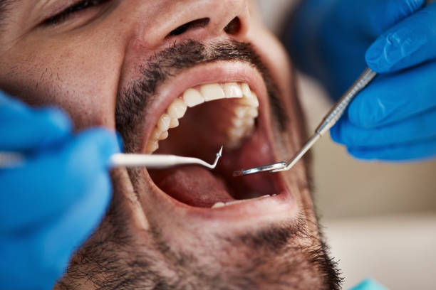 Best Emergency Root Canal Treatment in Palmyra, IN